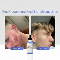 GHK-Cu Peptiden Serum